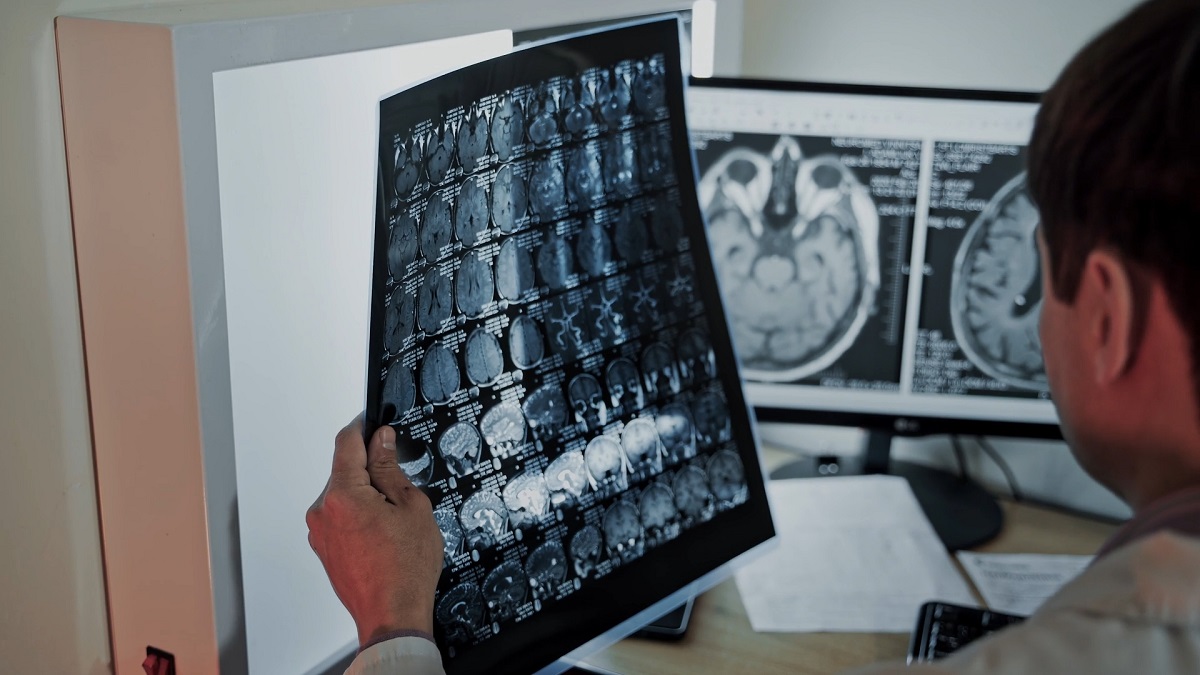 A doctor examines a brain scan on a lightbox while additional brain scans are displayed on a computer monitor